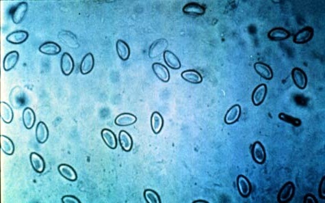 Яйца от хелминти: снимка под микроскоп